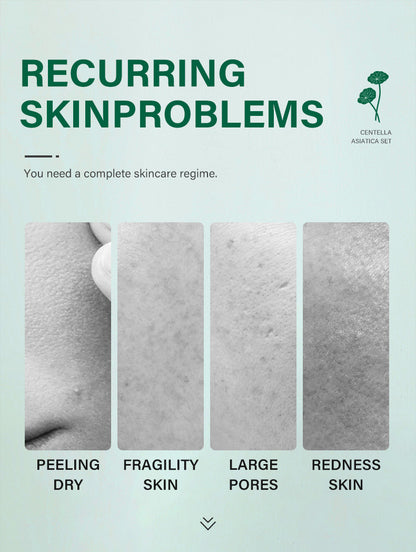 Private Label Skin Repair Centella Skin Care Kit Soothes Acne Face Care